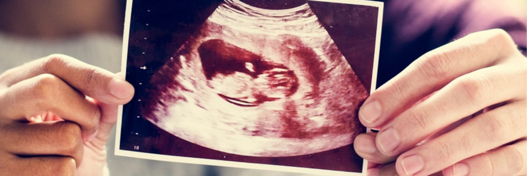 Couple holding a printed scan of their unborn baby